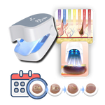 Laser Treatment for Painless Nail Fungus Removal