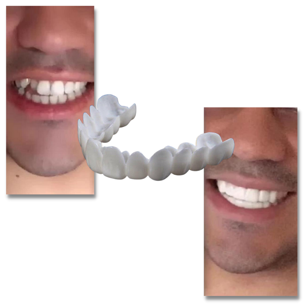 Dental Plan for Perfect Smile - Comfortable Aligners