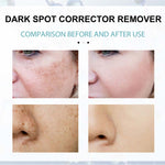 Anti-Dark Spot Cream for Pigmentation Lightening