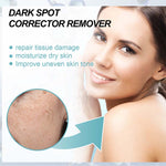 Anti-Dark Spot Cream for Pigmentation Lightening