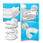 Advanced Anti-Snoring Device