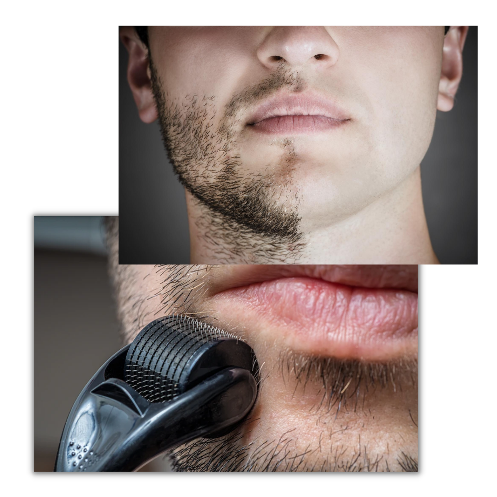 Hair & Beard Growth Dermal Roller