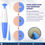 Kit Auto pour Retrait de Verrues - Enlèvement Facile à Domicile