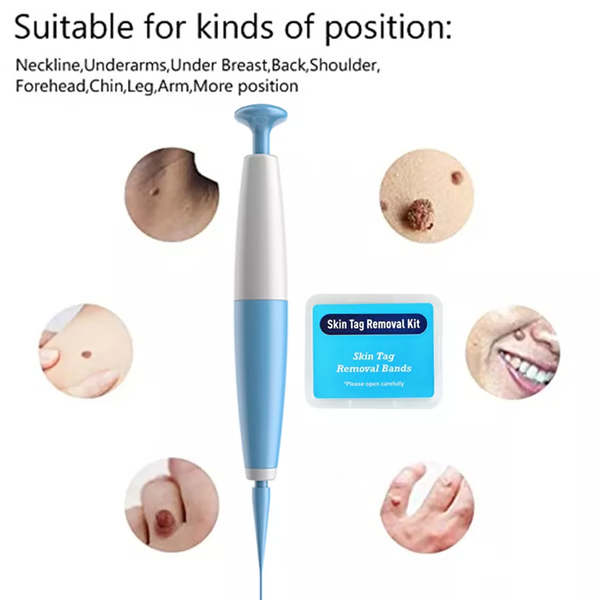 Kit Auto pour Retrait de Verrues - Enlèvement Facile à Domicile