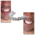 Dental Plan for Perfect Smile - Comfortable Aligners