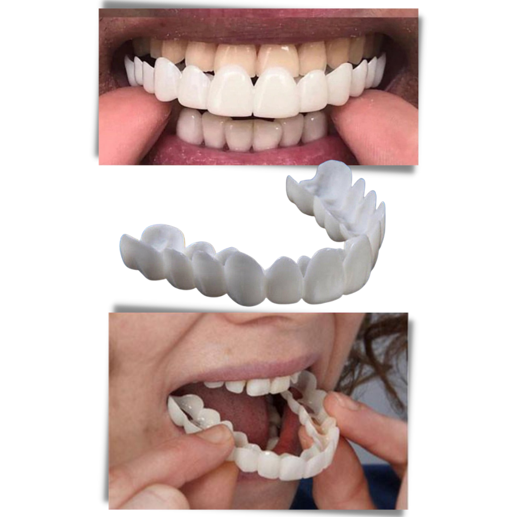 Dental Plan for Perfect Smile - Comfortable Aligners