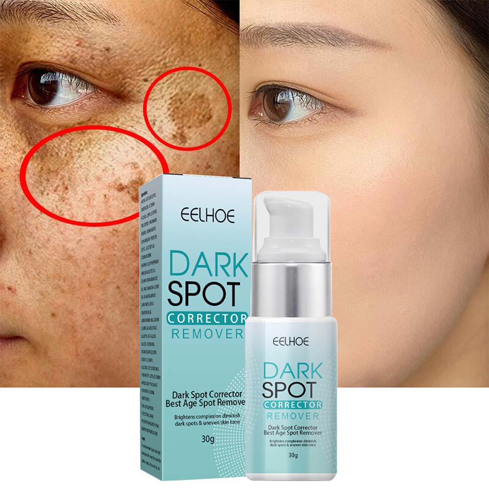 Anti-Dark Spot Cream for Pigmentation Lightening