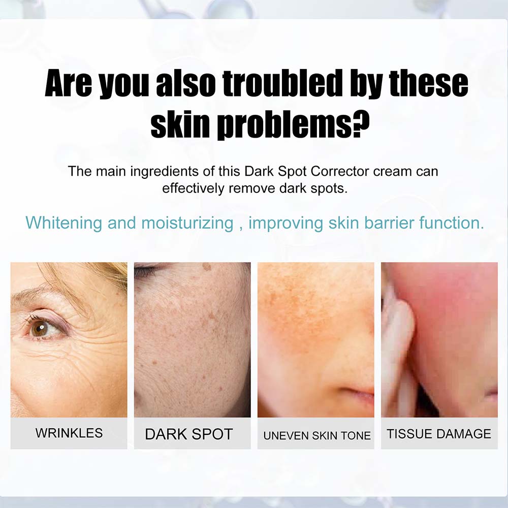 Anti-Dark Spot Cream for Pigmentation Lightening