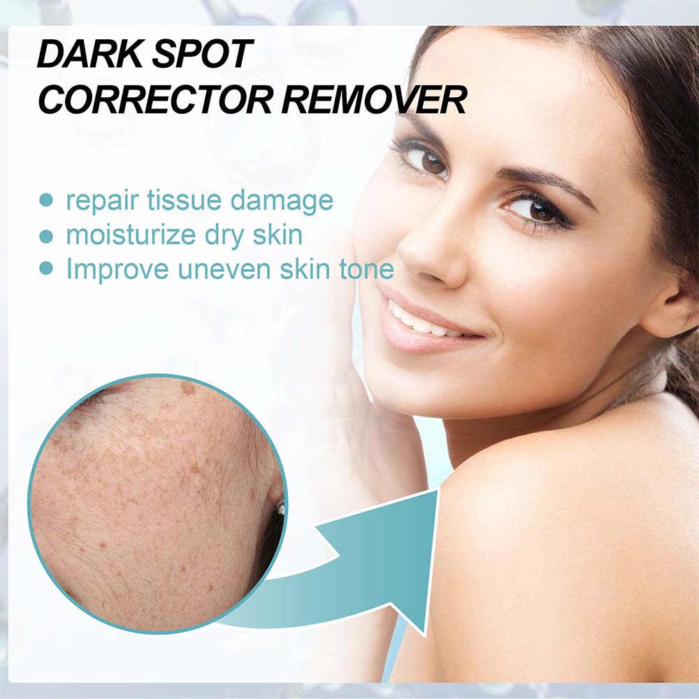 Anti-Dark Spot Cream for Pigmentation Lightening
